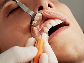 laser gum surgery